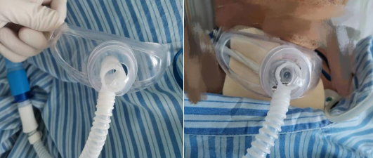 神經(jīng)外科提升優(yōu)質(zhì)服務改善護理質(zhì)量的舉措(圖2)