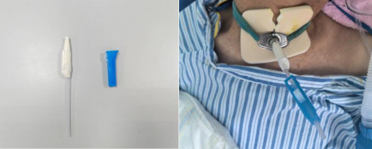 神經(jīng)外科提升優(yōu)質(zhì)服務改善護理質(zhì)量的舉措(圖3)